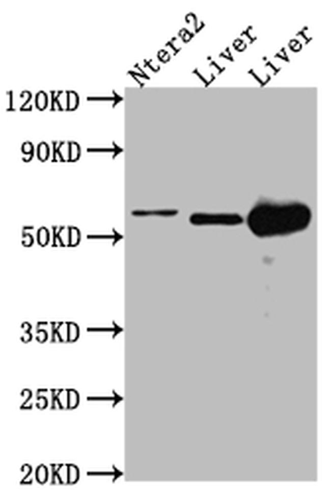 ALDH2 Antibody in Western Blot (WB)