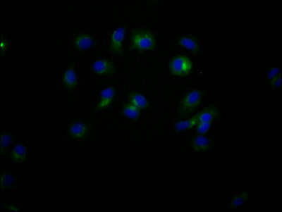 CD47 Antibody in Immunocytochemistry (ICC/IF)