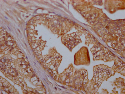 CD47 Antibody in Immunohistochemistry (Paraffin) (IHC (P))