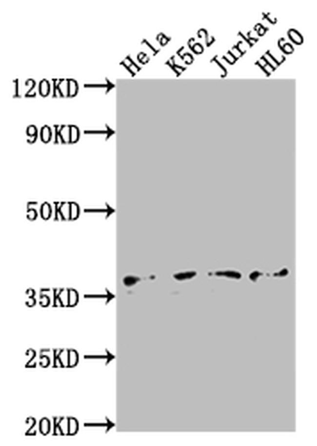 TBP Antibody in Western Blot (WB)