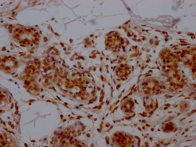 E2F1 Antibody in Immunohistochemistry (Paraffin) (IHC (P))