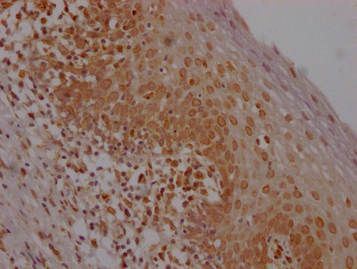 E2F1 Antibody in Immunohistochemistry (Paraffin) (IHC (P))