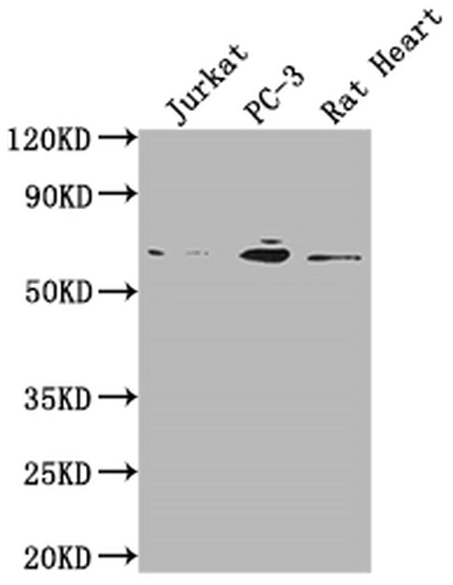 E2F1 Antibody in Western Blot (WB)