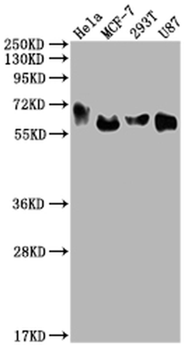 GBA Antibody in Western Blot (WB)