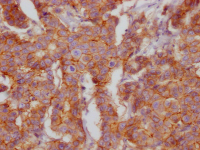 CD46 Antibody in Immunohistochemistry (Paraffin) (IHC (P))