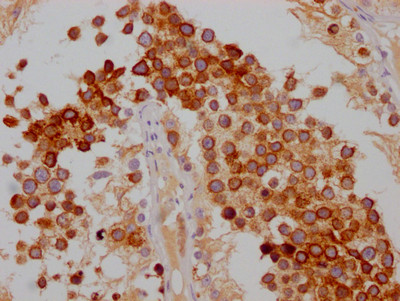 FDFT1 Antibody in Immunohistochemistry (Paraffin) (IHC (P))