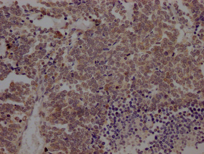 BMI-1 Antibody in Immunohistochemistry (Paraffin) (IHC (P))