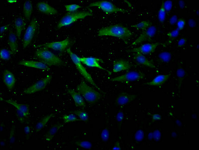 AKT1 Antibody in Immunocytochemistry (ICC/IF)