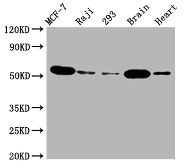 AKT1 Antibody in Western Blot (WB)