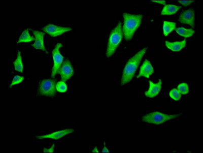 COX2 Antibody in Immunocytochemistry (ICC/IF)