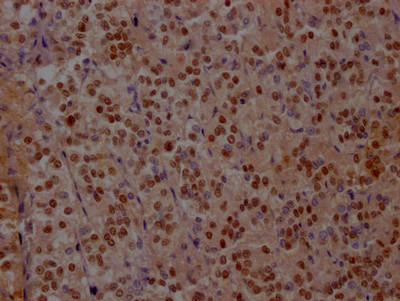 ISL1 Antibody in Immunohistochemistry (Paraffin) (IHC (P))