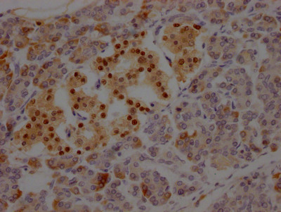 ISL1 Antibody in Immunohistochemistry (Paraffin) (IHC (P))