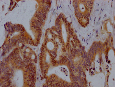 VDR Antibody in Immunohistochemistry (Paraffin) (IHC (P))