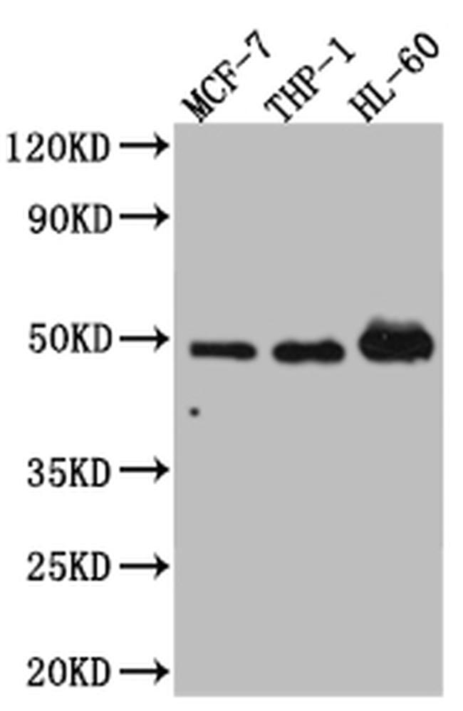 VDR Antibody in Western Blot (WB)