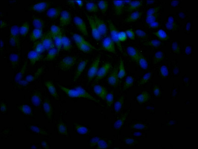 HDAC2 Antibody in Immunocytochemistry (ICC/IF)