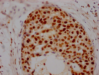 HDAC2 Antibody in Immunohistochemistry (Paraffin) (IHC (P))