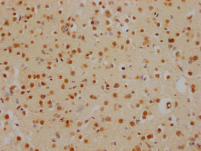 HDAC2 Antibody in Immunohistochemistry (Paraffin) (IHC (P))