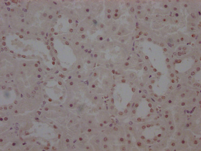 WT1 Antibody in Immunohistochemistry (Paraffin) (IHC (P))