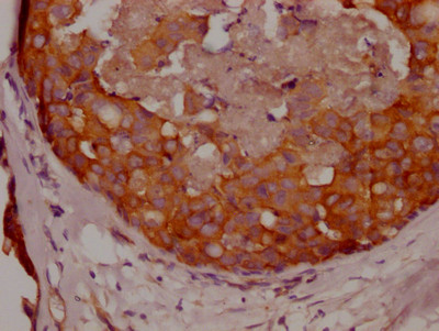 Protein APC Antibody in Immunohistochemistry (Paraffin) (IHC (P))