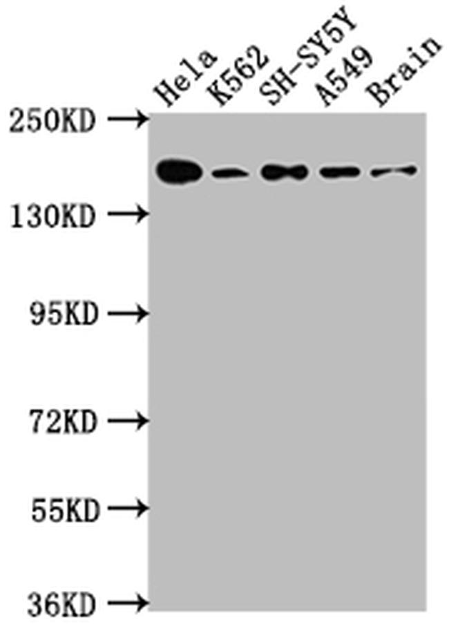 Protein APC Antibody in Western Blot (WB)