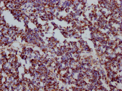 HSP60 Antibody in Immunohistochemistry (Paraffin) (IHC (P))