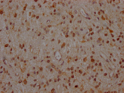 MEK1 Antibody in Immunohistochemistry (Paraffin) (IHC (P))