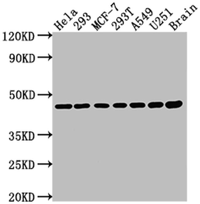 MEK1 Antibody in Western Blot (WB)