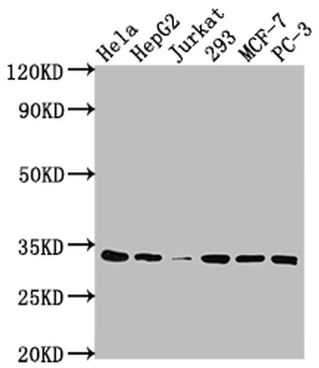 CDK4 Antibody in Western Blot (WB)