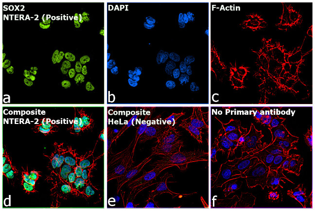 SOX2 Antibody in Immunocytochemistry (ICC/IF)