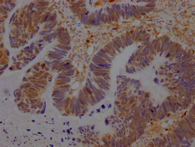 GRB2 Antibody in Immunohistochemistry (Paraffin) (IHC (P))