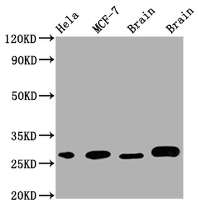 GRB2 Antibody in Western Blot (WB)