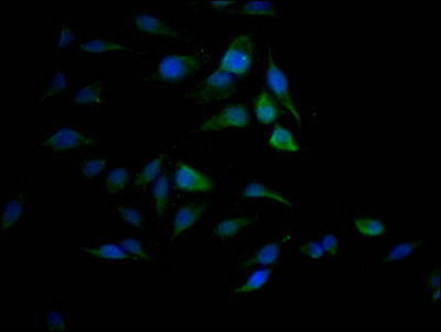 SAE1 Antibody in Immunocytochemistry (ICC/IF)