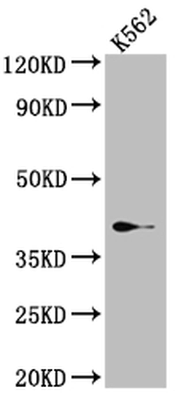 SAE1 Antibody in Western Blot (WB)