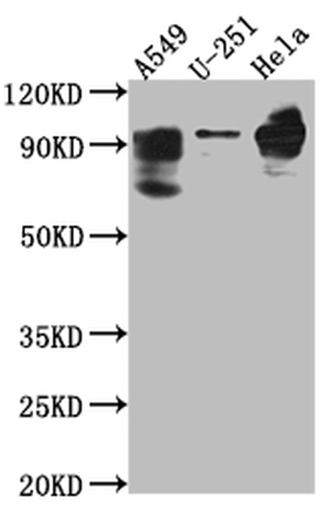 PDE4D Antibody in Western Blot (WB)