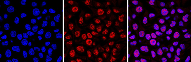 5-Methylcytosine Antibody in Immunocytochemistry (ICC/IF)