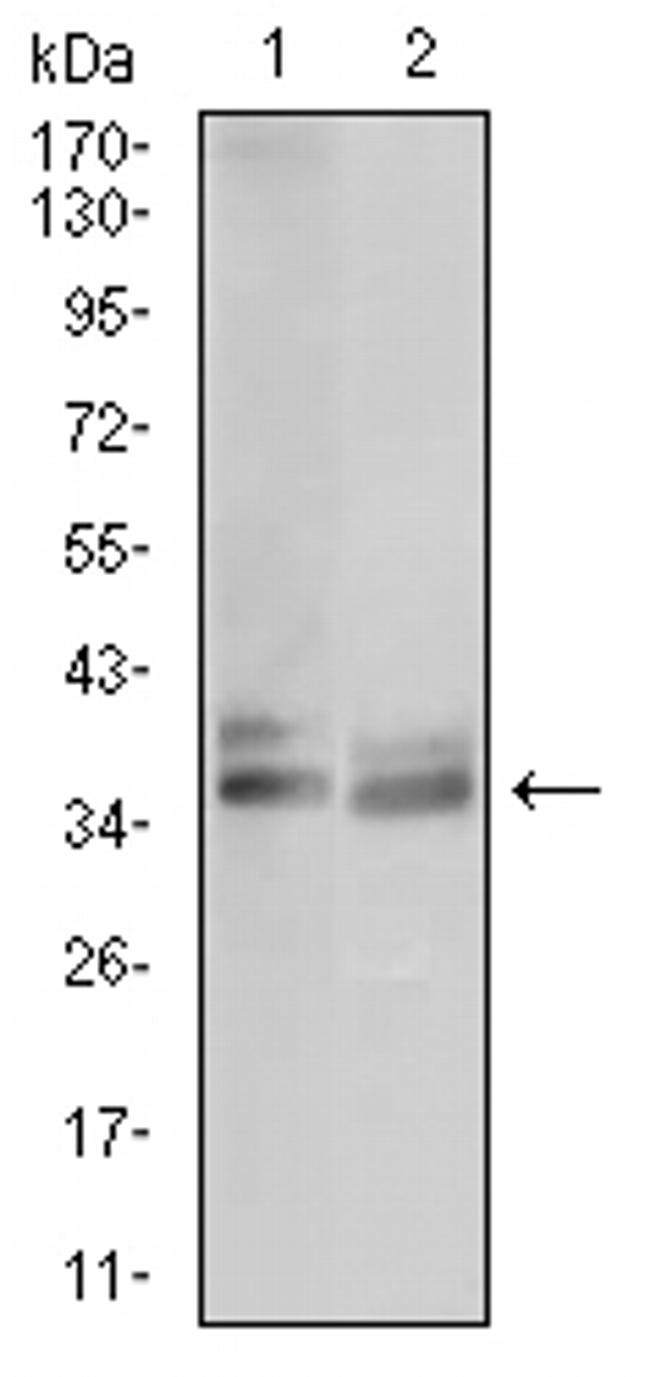 Tartrate Resistant Acid Phosphatase Antibody in Western Blot (WB)