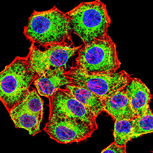 ACTH Antibody in Immunocytochemistry (ICC/IF)