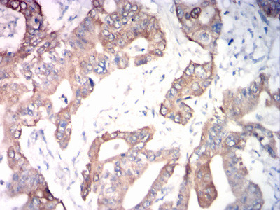 ADAM10 Antibody in Immunohistochemistry (Paraffin) (IHC (P))