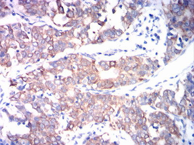 ADAM10 Antibody in Immunohistochemistry (Paraffin) (IHC (P))