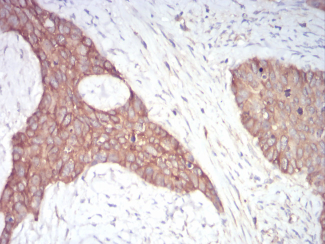 alpha Adducin Antibody in Immunohistochemistry (Paraffin) (IHC (P))