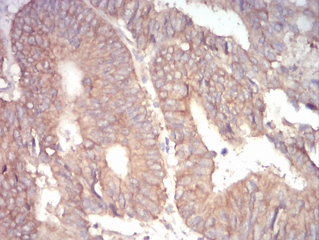 alpha Adducin Antibody in Immunohistochemistry (Paraffin) (IHC (P))