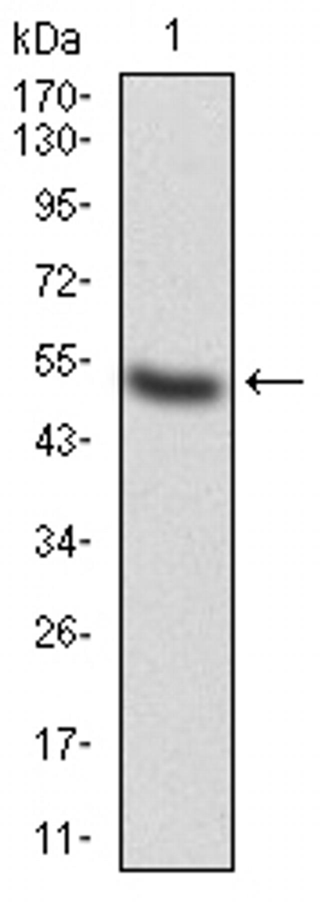 alpha Adducin Antibody in Western Blot (WB)