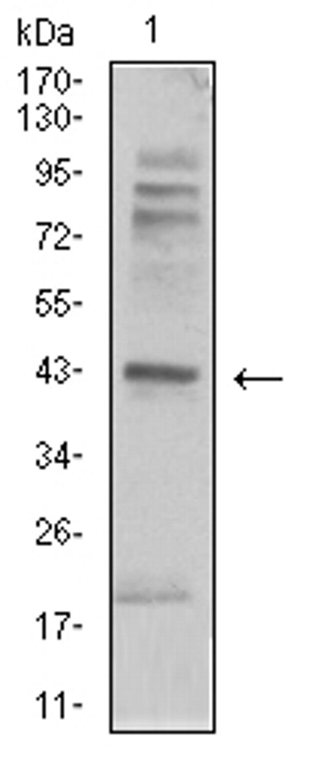 beta-2 Adrenergic Receptor Antibody in Western Blot (WB)