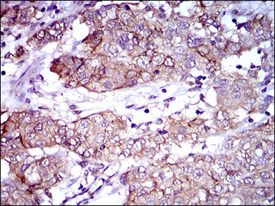 CD166 Antibody in Immunohistochemistry (Paraffin) (IHC (P))