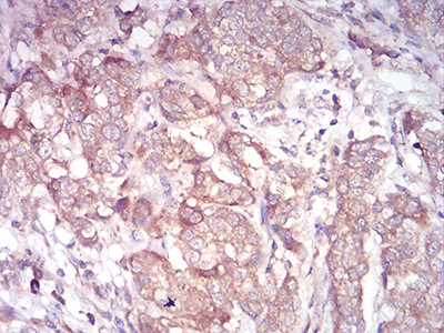 ARF1 Antibody in Immunohistochemistry (Paraffin) (IHC (P))