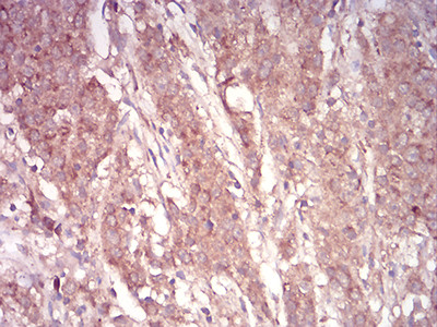 ARF1 Antibody in Immunohistochemistry (Paraffin) (IHC (P))