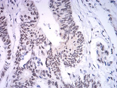 ASH2L Antibody in Immunohistochemistry (Paraffin) (IHC (P))