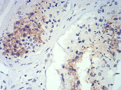 ATG14 Antibody in Immunohistochemistry (Paraffin) (IHC (P))