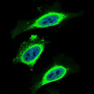 beta-2 Microglobulin Antibody in Immunocytochemistry (ICC/IF)