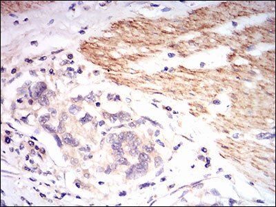 beta-2 Microglobulin Antibody in Immunohistochemistry (Paraffin) (IHC (P))